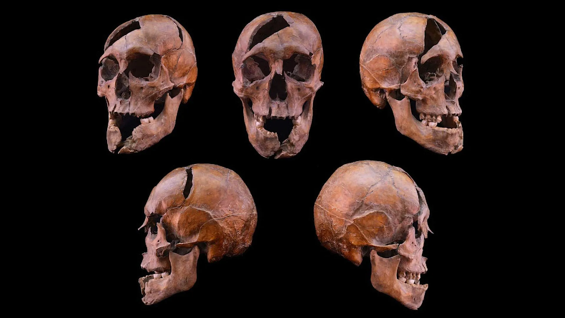 Scientists Solve a 700-Year-Old Royal Murder via Forensics